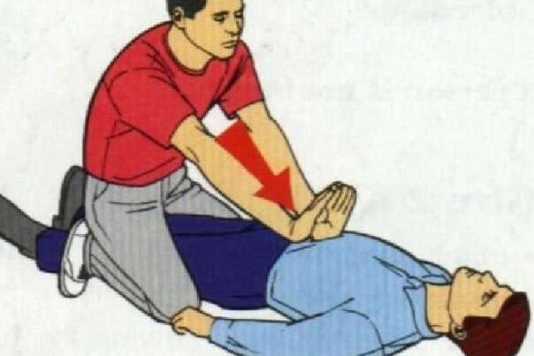 海姆立克的正确手法