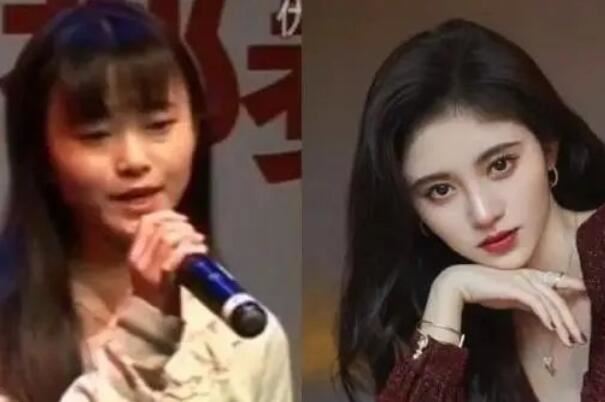 鞠婧祎整容前后对比判若两人