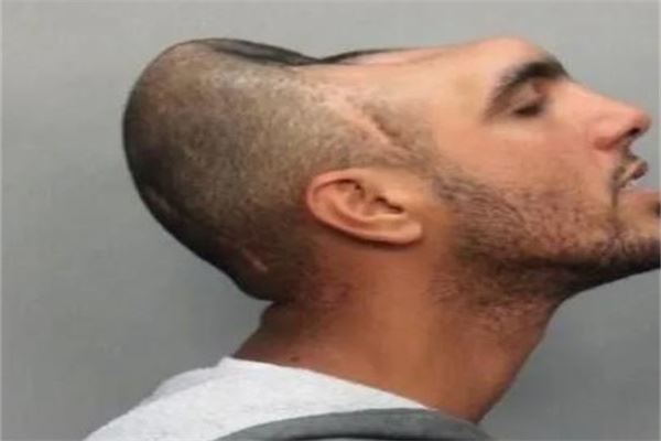 半脑哥活了多久